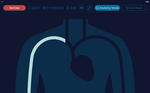 NAV+ real time tip navigation and feedback